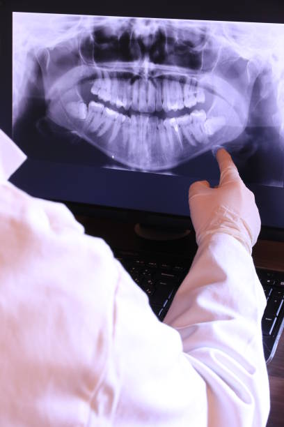 Best Emergency Dentist for Lost Fillings or Crowns in Shafter, CA